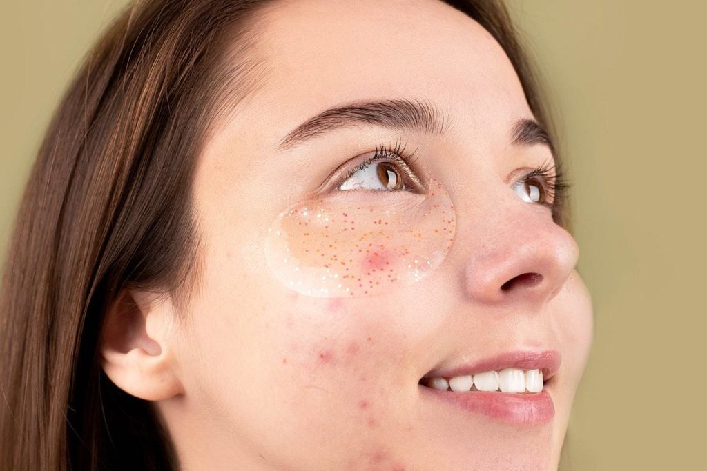 Skincare Tips For Acne
